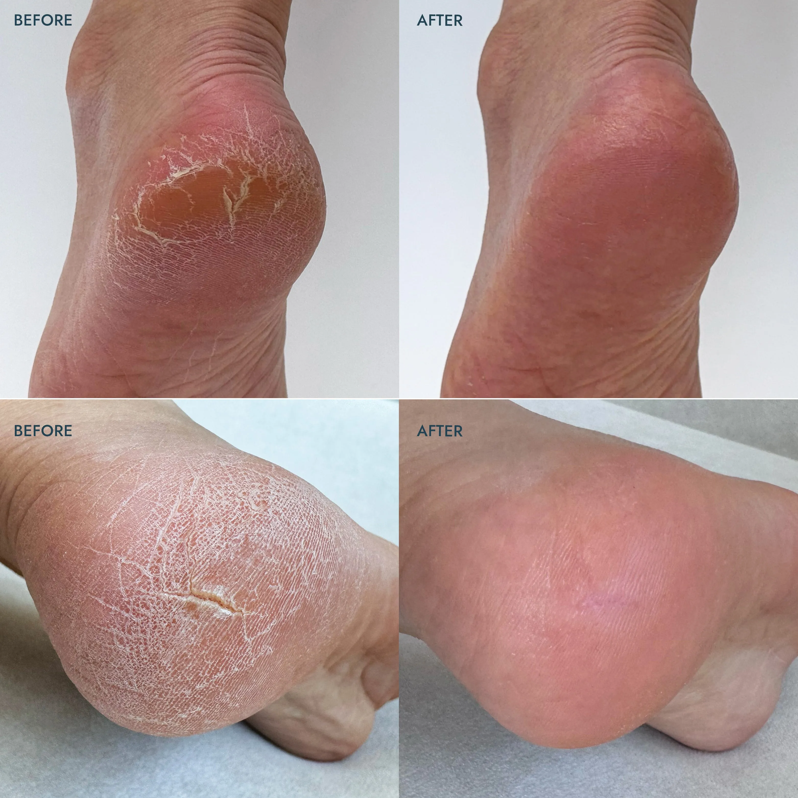 Heel Repair Duo Lavender